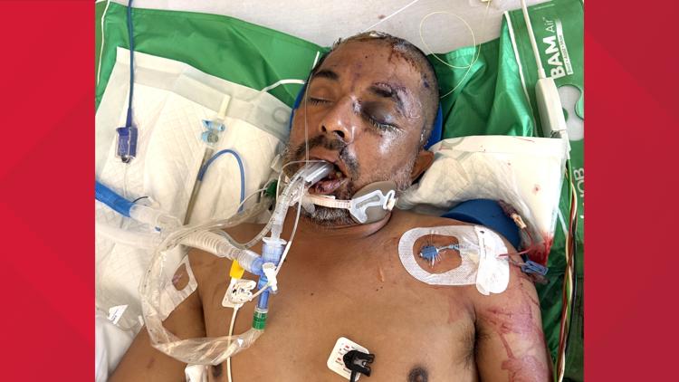 University Hospital asks for help identifying unconscious patient hit by truck Saturday evening — KENS 5 (San Antonio), New Hope Health news