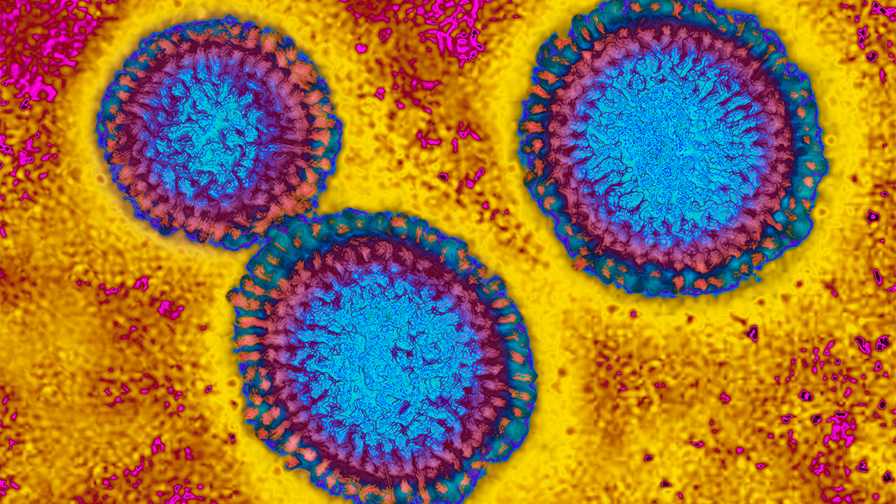 Flu hospitalizations 'slightly higher' than usual, officials urge vaccinations — FOX 9, New Hope Health news